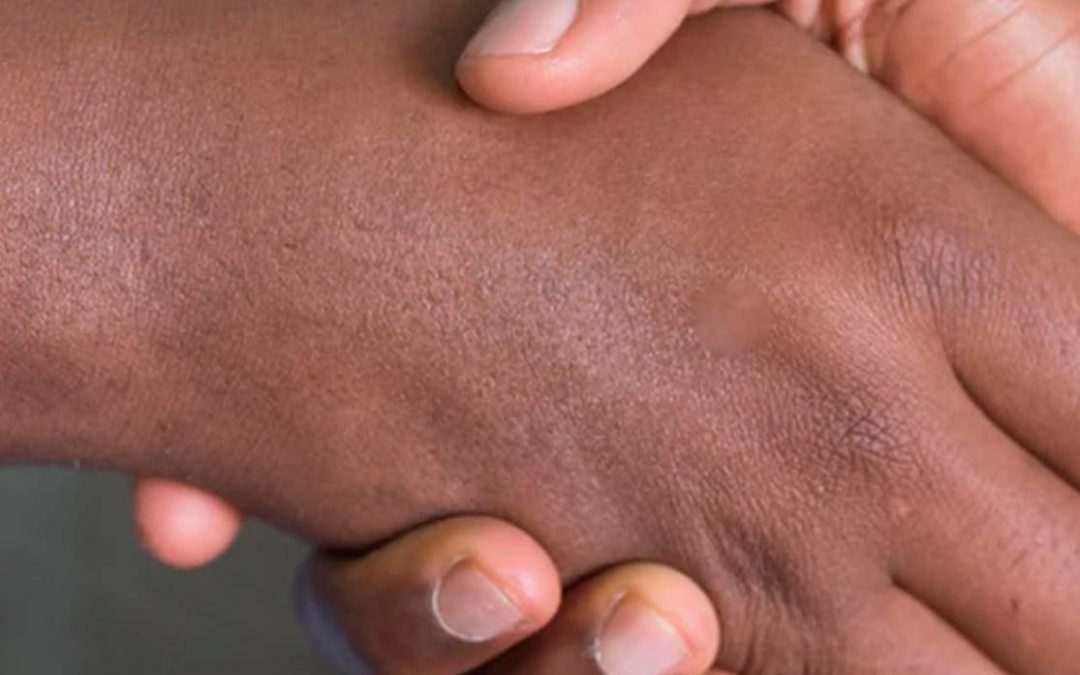 Sensory Motor Integration & Chiropractic