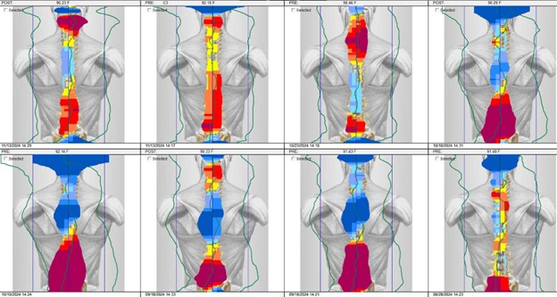 Progress of Thermography Scans