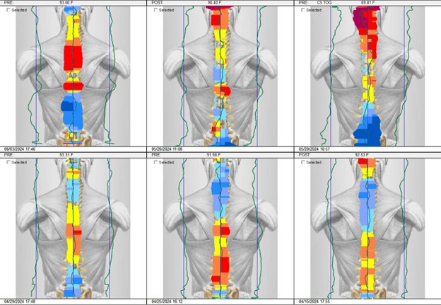 Thermal Scan images for a patient over several visits