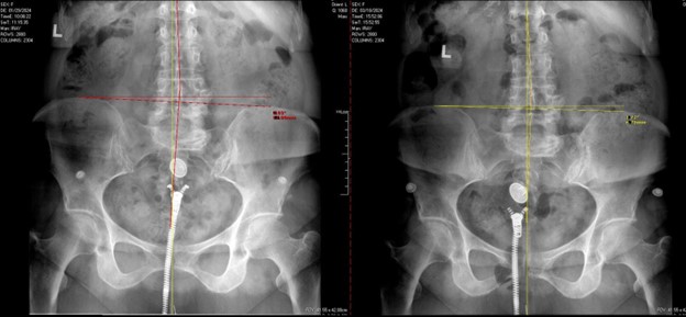 Patient X-Ray progress over 2 months of care