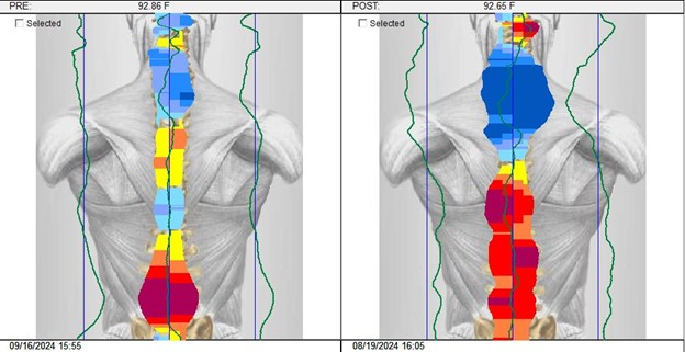 Thermal scan of patient before and after adjustment for specific symptom