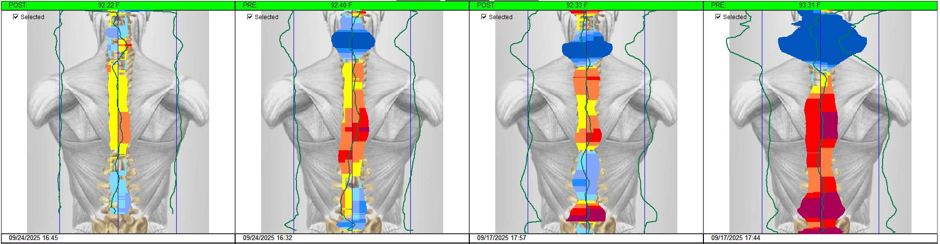 Patient X-Ray progress over 2 months of care